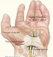 Conditions for Hand Surgery and What to Expect