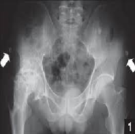 Patient Orientation and AP Pelvis x-ray using Radiography