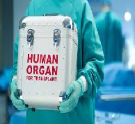 Organ Donation Argumentative Essay