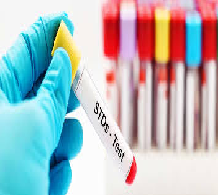 Testing for Sexually Transmitted Infections
