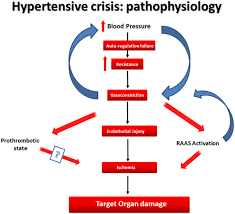 Pathophysiological Factors That Influence Hypertension