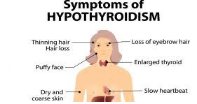 Hyperthyroidism Diagnosis and Symptoms